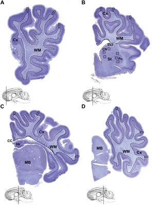 Impact of High-Dose Caffeine on the Preterm Ovine Cerebrum and Cerebellum